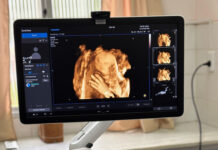 «Salto incorporó un ecógrafo con inteligencia artificial que fortalece la atención primaria de salud»